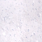 Immunohistochemical staining of human skeletal muscle shows no positivity in myocytes as expected.