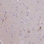 Anti-PRR14L Antibody