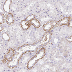 Anti-PRR14L Antibody