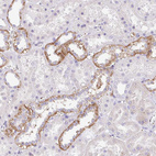 Immunohistochemical staining of human kidney shows strong cytoplasmic positivity in subset of cells in tubules.