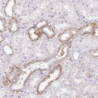 Immunohistochemical staining of human kidney shows strong cytoplasmic positivity in subset of cells in tubules.