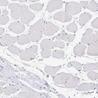 Immunohistochemical staining of human skeletal muscle shows no positivity in myocytes as expected.
