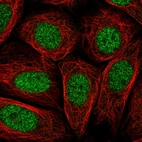 Immunofluorescent staining of human cell line SiHa shows localization to nucleoplasm.