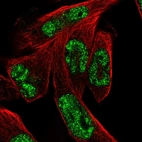Anti-MSANTD3 Antibody