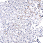 Anti-MSLN Antibody