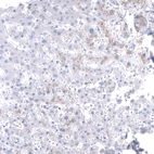 Immunohistochemical staining of human liver shows no positivity in hepatocytes as expected.