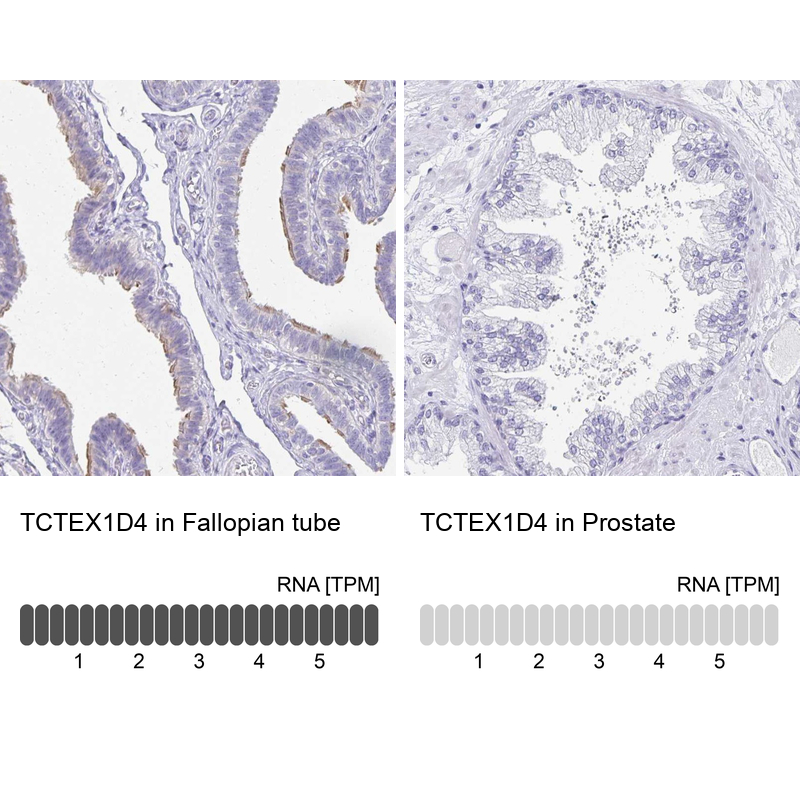 Anti-TCTEX1D4 Antibody