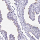Immunohistochemical staining of human fallopian tube shows high expression.