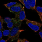 Anti-PCDH20 Antibody