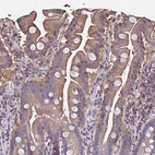 Anti-RPRML Antibody