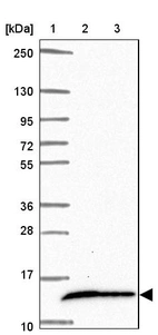 Lane 1: Marker [kDa] 250, 130, 95, 72, 55, 36, 28, 17, 10_br/_Lane 2: Human cell line RT-4_br/_Lane 3: Human cell line U-251MG sp