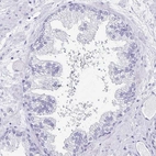 Immunohistochemical staining of human prostate shows low expression as expected.