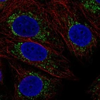 Immunofluorescent staining of human cell line MCF7 shows localization to mitochondria.