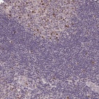 Anti-KIFC1 Antibody