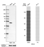 Western blot analysis in human cell lines HeLa and PC-3 using Anti-MSLN antibody. Corresponding MSLN RNA-seq data are presented for the same cell lines. Loading control: Anti-HSP90B1.