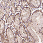 Immunohistochemical staining of human stomach shows moderate membranous positivity in glandular cells.