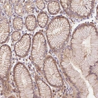 Immunohistochemical staining of human stomach shows moderate membranous positivity in glandular cells.