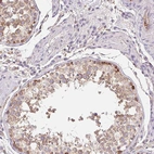 Immunohistochemical staining of human testis shows moderate membranous/cytoplasmic positivity in cells in seminiferous ducts.