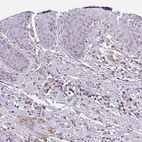 Immunohistochemical staining of human skin shows no positivity in squamous epithelial cells, as expected.