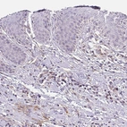 Immunohistochemical staining of human skin shows no positivity in squamous epithelial cells, as expected.