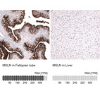 Anti-MSLN Antibody