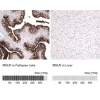 Anti-MSLN Antibody