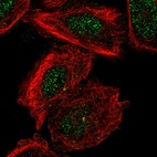 Immunofluorescent staining of human cell line PC-3 shows localization to nucleoplasm & centrosome.