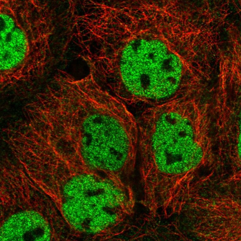 Anti-ORAOV1 Antibody
