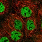 Anti-ORAOV1 Antibody