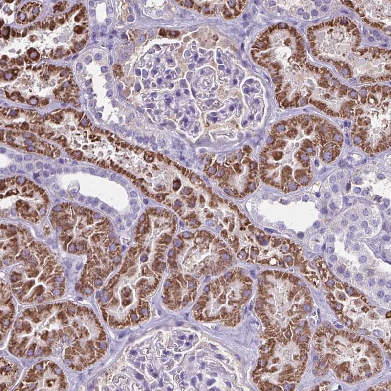 Anti-GDF5OS Antibody