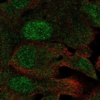 Immunofluorescent staining of human cell line A549 shows localization to nucleus & cytosol.