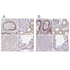Anti-RSL24D1 Antibody