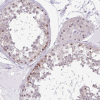 Immunohistochemical staining of human testis shows strong positivity in nucleoli in cells in seminiferous ducts and in Leydig cells.