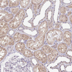 Immunohistochemical staining of human kidney shows strong positivity in nucleoli in cells in tubules.