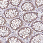 Immunohistochemical staining of human colon shows strong positivity in nucleoli in glandular cells.