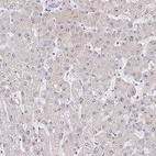 Immunohistochemical staining of human liver shows strong positivity in nucleoli in hepatocytes.