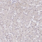 Immunohistochemical staining of human liver shows strong positivity in nucleoli in hepatocytes.