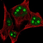 Immunofluorescent staining of human cell line SK-MEL-30 shows localization to nucleus & nucleoli.
