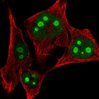 Immunofluorescent staining of human cell line SK-MEL-30 shows localization to nucleus & nucleoli.