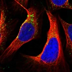 Immunofluorescent staining of human cell line U-2 OS shows localization to vesicles.