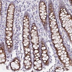 Anti-PRR36 Antibody