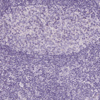 Immunohistochemical staining of human tonsil shows no positivity as expected.
