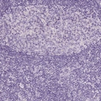 Immunohistochemical staining of human tonsil shows no positivity as expected.