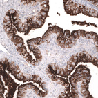 Anti-MSLN Antibody