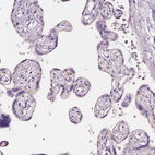 Immunohistochemical staining of human placenta shows no positivity in trophoblastic cells as expected.