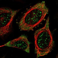 Anti-PSKH1 Antibody