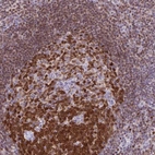 Anti-DCK Antibody