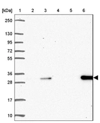 Lane 1: Marker [kDa] 250, 130, 95, 72, 55, 36, 28, 17, 10_br/_Lane 2: Human cell line RT-4_br/_Lane 3: Human cell line U-251 MG_br/_Lane 4: Human plasma_br/_Lane 5: Human Liver tissue_br/_Lane 6: Human Tonsil tissue