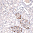 Anti-MSLN Antibody