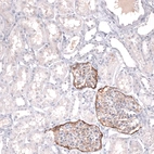 Immunohistochemical staining of human kidney shows moderate membranous positivity in cells in glomeruli.
